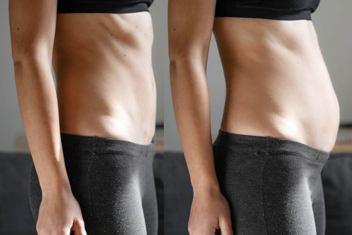 How long does diastasis recti take to improve Ayr?