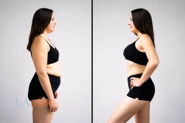 link between body image and mental health Ayr